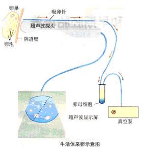 采集卵母细胞的方法